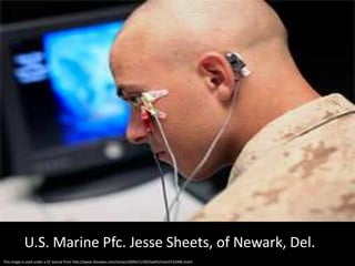 U.S. Marine Pfc. Jesse Sheets, of Newark, Del.This image is used under a CC license from http://www.cbsnews.com/stories/2009/11/20/health/main5722496.shtml