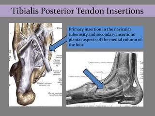 Tibialis Posterior Tendon Insertions
               Primary insertion in the navicular
               tuberosity and secondary insertions
               plantar aspects of the medial column of
               the foot.
 