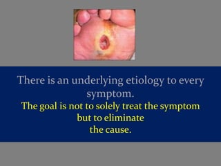 There is an underlying etiology to every
              symptom.
The goal is not to solely treat the symptom
             but to eliminate
                 the cause.
 