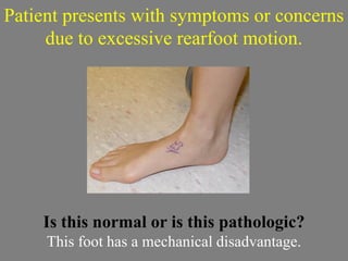 Patient presents with symptoms or concerns
     due to excessive rearfoot motion.




    Is this normal or is this pathologic?
     This foot has a mechanical disadvantage.
 