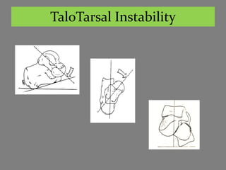 TaloTarsal Instability
 