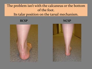The problem isn’t with the calcaneus or the bottom
                     of the foot.
    Its talar position on the tarsal mechanism.
        RCSP                       NCSP
 