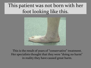 This patient was not born with her
      foot looking like this.




  This is the result of years of “conservative” treatment.
 Her specialists thought that they were “doing no harm”
          in reality they have caused great harm.
 