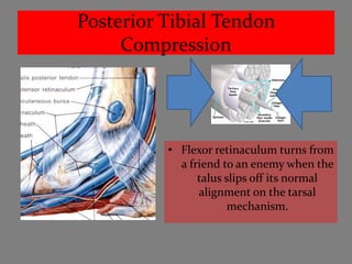 Posterior Tibial Tendon
     Compression




          • Flexor retinaculum turns from
            a friend to an enemy wh...