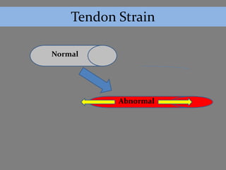 Tendon Strain

Normal




           Abnormal
 