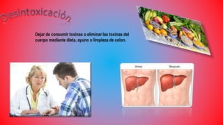 Dejar de consumir toxinas o eliminar las toxinas del
cuerpo mediante dieta, ayuno o limpieza de colon.
 