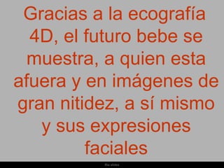 Gracias a la ecografía
  4D, el futuro bebe se
  muestra, a quien esta
afuera y en imágenes de
gran nitidez, a sí mismo
   y sus expresiones
         faciales
          Ria slides
 