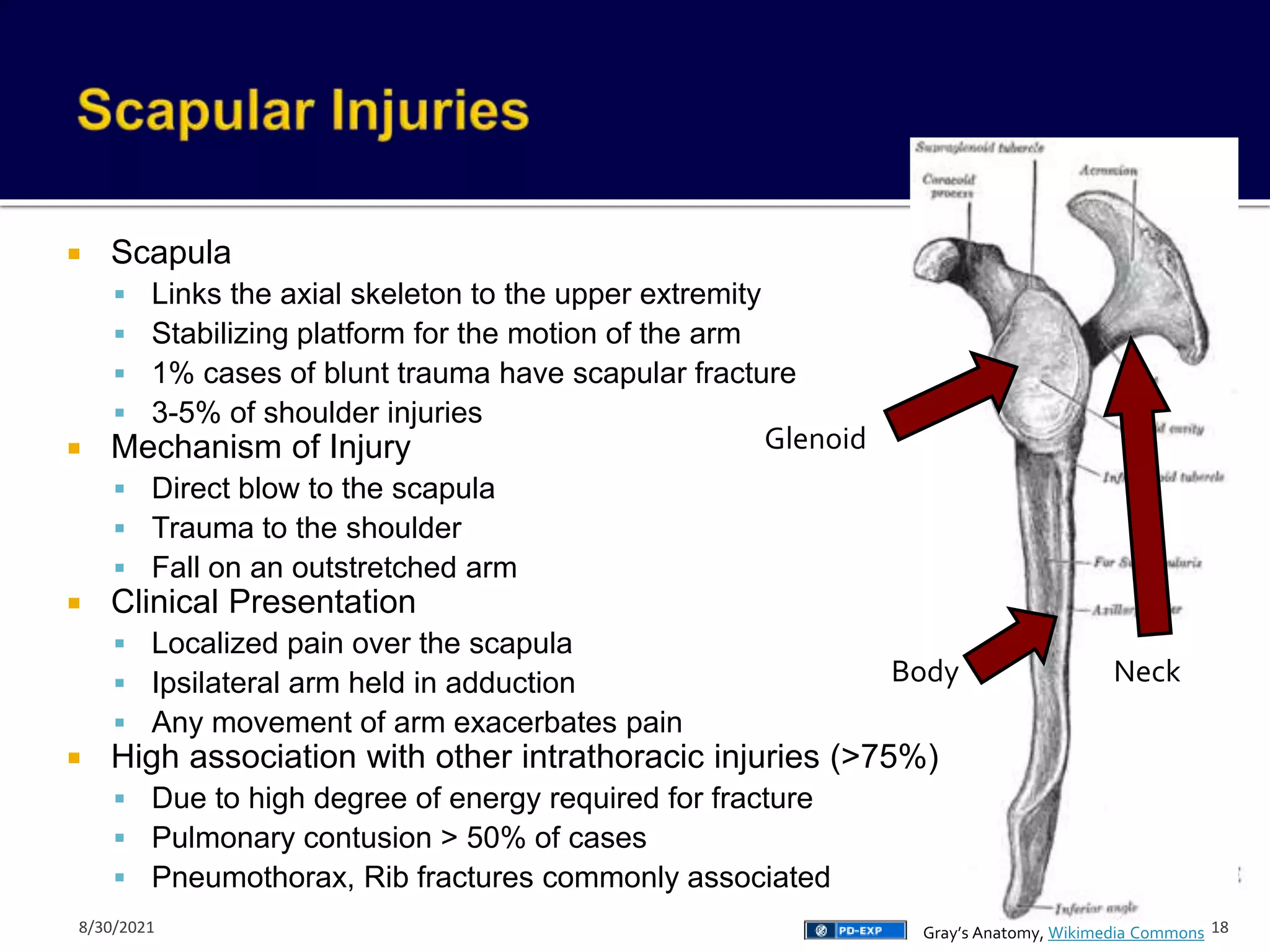  Scapula
 Links the axial skeleton to the upper extremity
 Stabilizing platform for the motion of the arm
 1% cases of blunt trauma have scapular fracture
 3-5% of shoulder injuries
 Mechanism of Injury
 Direct blow to the scapula
 Trauma to the shoulder
 Fall on an outstretched arm
 Clinical Presentation
 Localized pain over the scapula
 Ipsilateral arm held in adduction
 Any movement of arm exacerbates pain
 High association with other intrathoracic injuries (>75%)
 Due to high degree of energy required for fracture
 Pulmonary contusion > 50% of cases
 Pneumothorax, Rib fractures commonly associated
Glenoid
Body Neck
18
Gray’s Anatomy, Wikimedia Commons
8/30/2021
 