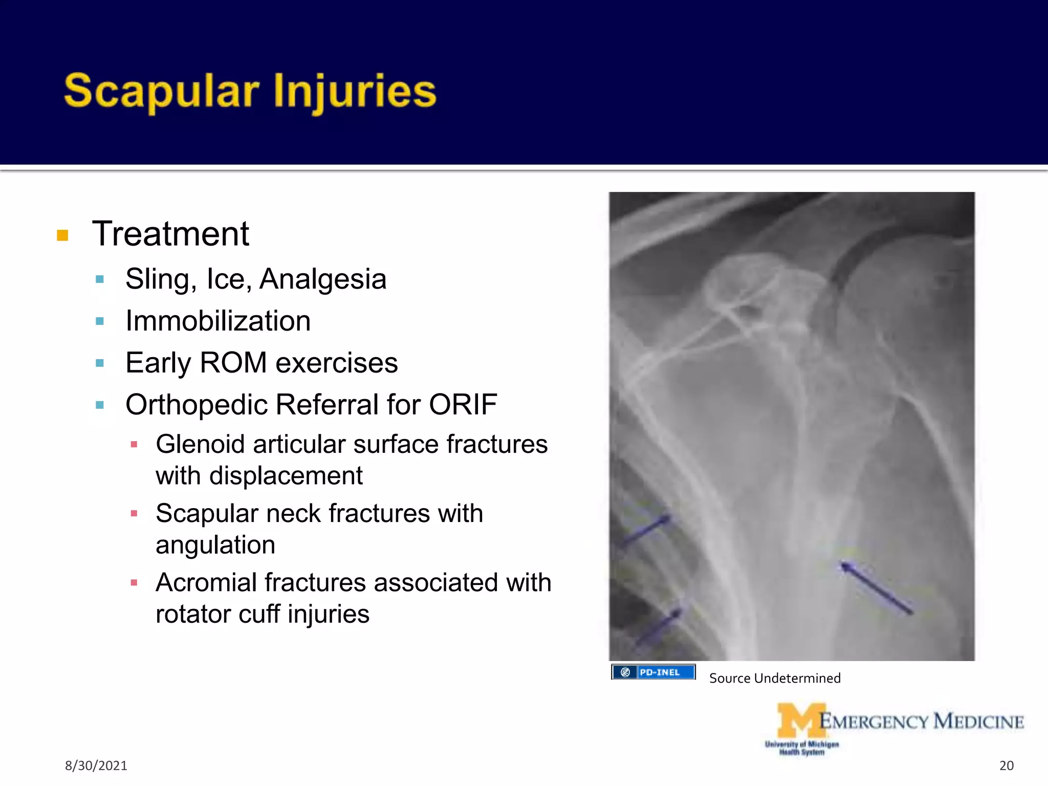  Treatment
 Sling, Ice, Analgesia
 Immobilization
 Early ROM exercises
 Orthopedic Referral for ORIF
▪ Glenoid articular surface fractures
with displacement
▪ Scapular neck fractures with
angulation
▪ Acromial fractures associated with
rotator cuff injuries
20
Source Undetermined
8/30/2021
 