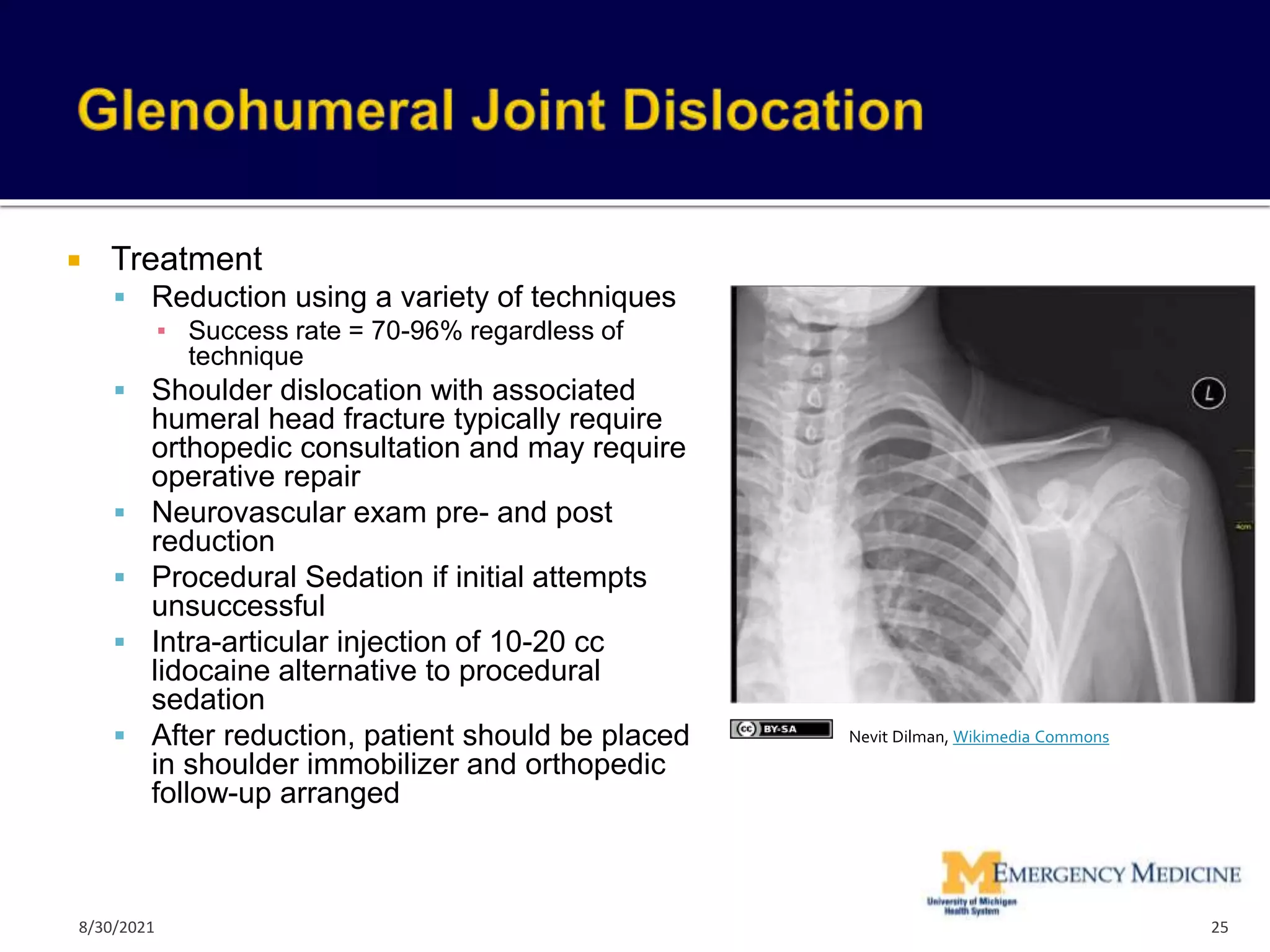  Treatment
 Reduction using a variety of techniques
▪ Success rate = 70-96% regardless of
technique
 Shoulder dislocation with associated
humeral head fracture typically require
orthopedic consultation and may require
operative repair
 Neurovascular exam pre- and post
reduction
 Procedural Sedation if initial attempts
unsuccessful
 Intra-articular injection of 10-20 cc
lidocaine alternative to procedural
sedation
 After reduction, patient should be placed
in shoulder immobilizer and orthopedic
follow-up arranged
25
Nevit Dilman, Wikimedia Commons
8/30/2021
 