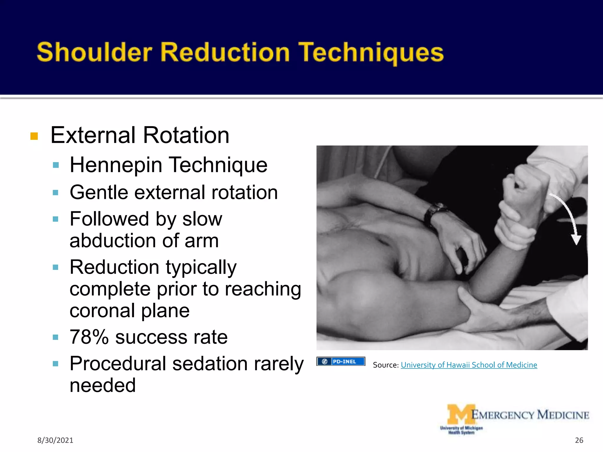  External Rotation
 Hennepin Technique
 Gentle external rotation
 Followed by slow
abduction of arm
 Reduction typically
complete prior to reaching
coronal plane
 78% success rate
 Procedural sedation rarely
needed
26
Source: University of Hawaii School of Medicine
8/30/2021
 