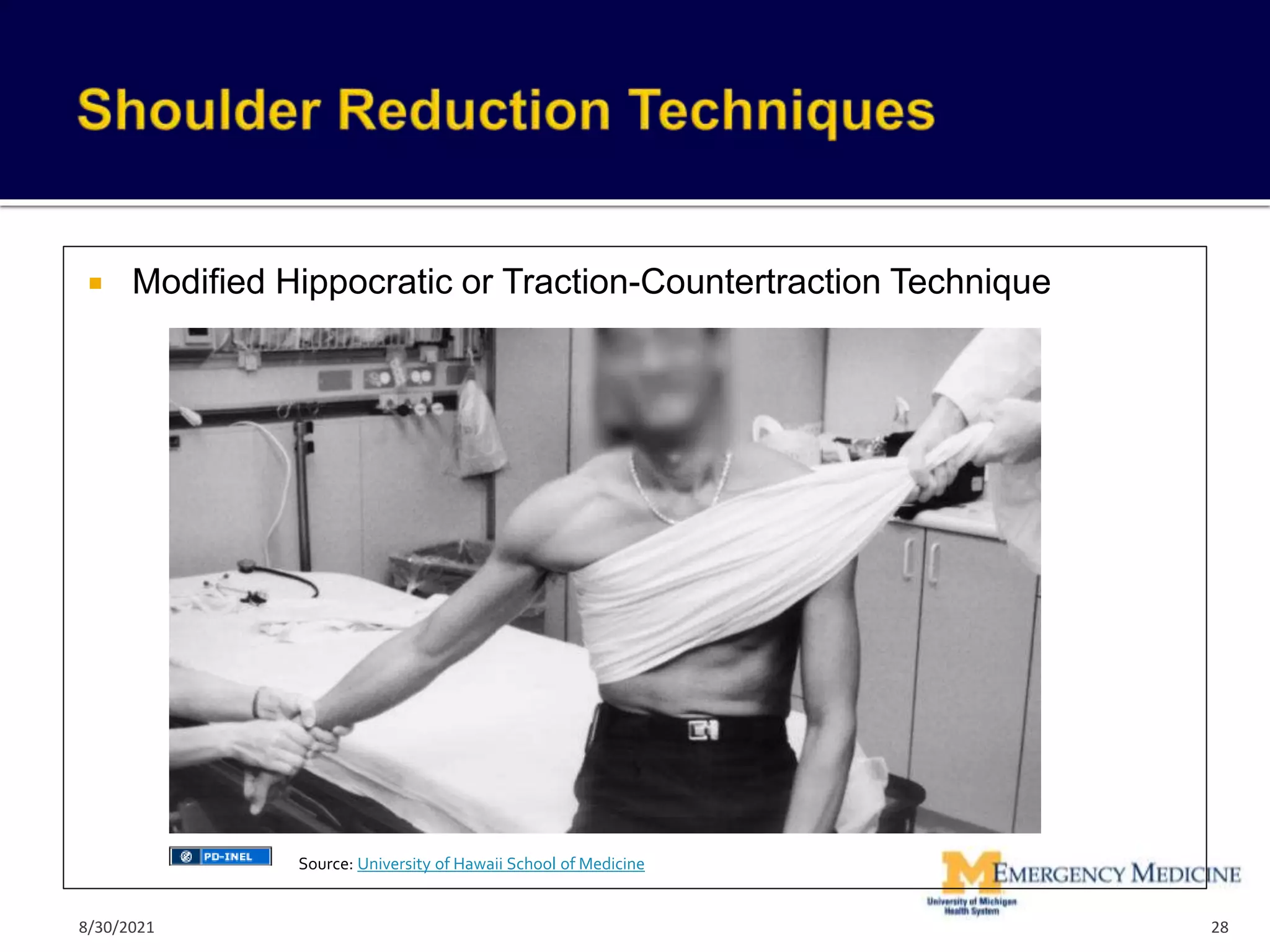  Modified Hippocratic or Traction-Countertraction Technique
28
Source: University of Hawaii School of Medicine
8/30/2021
 