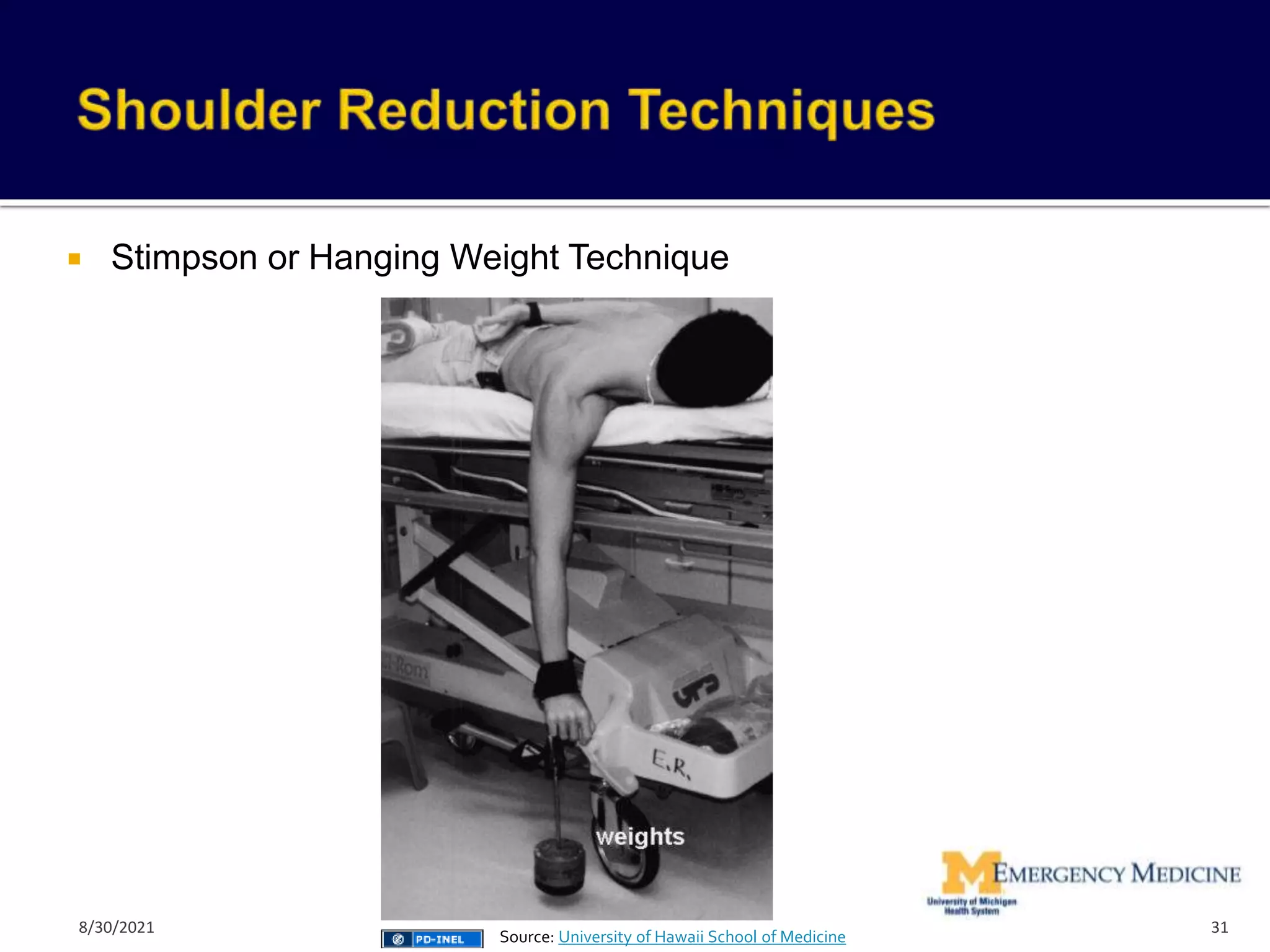  Stimpson or Hanging Weight Technique
31
Source: University of Hawaii School of Medicine
8/30/2021
 