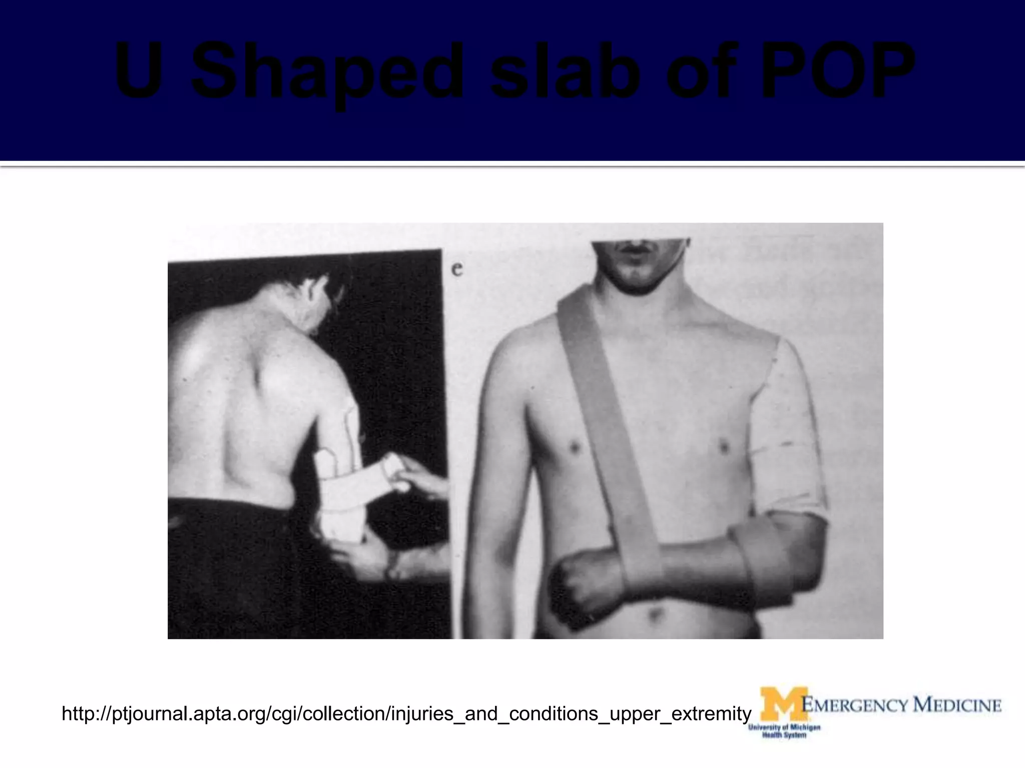 http://ptjournal.apta.org/cgi/collection/injuries_and_conditions_upper_extremity
 
