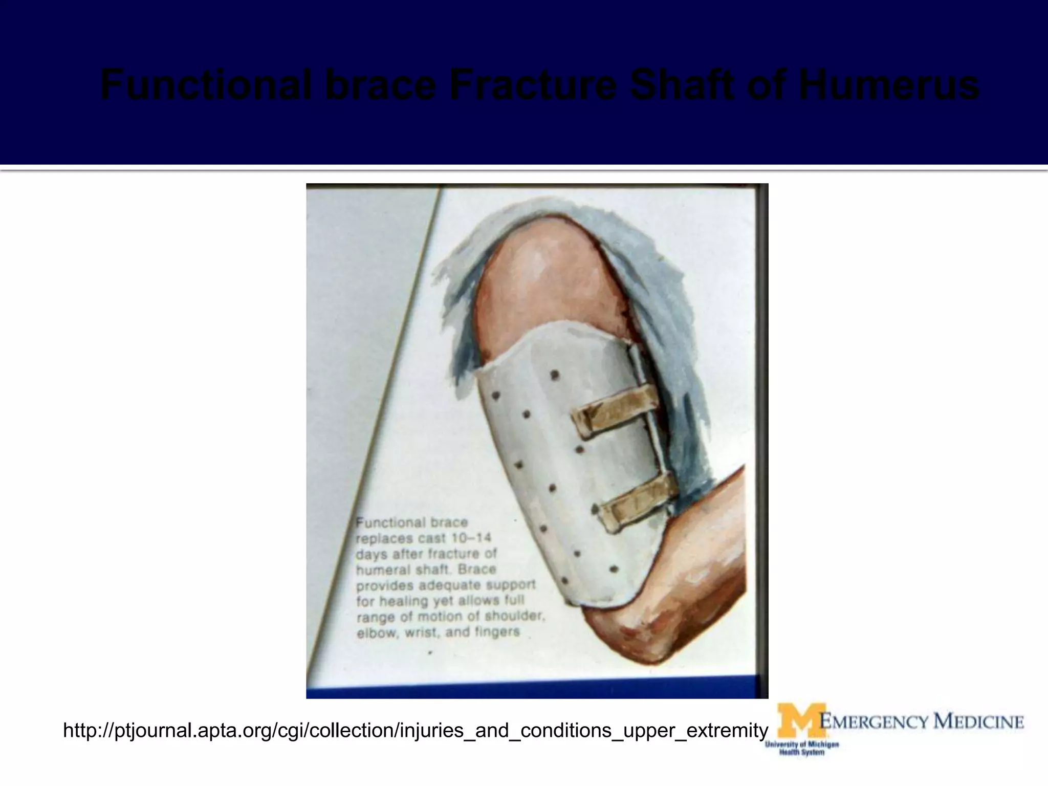http://ptjournal.apta.org/cgi/collection/injuries_and_conditions_upper_extremity
 