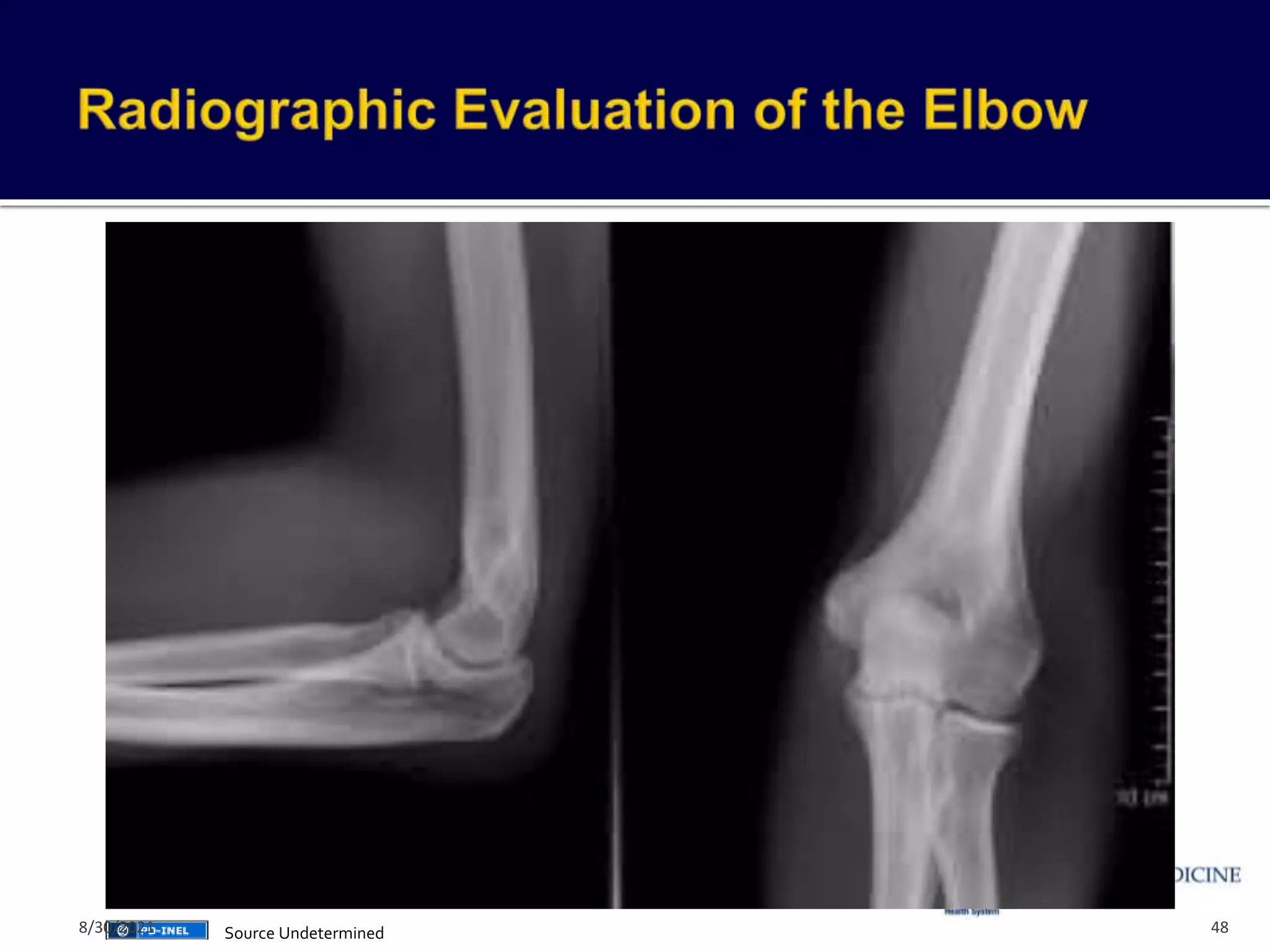 48
Source Undetermined
8/30/2021
 