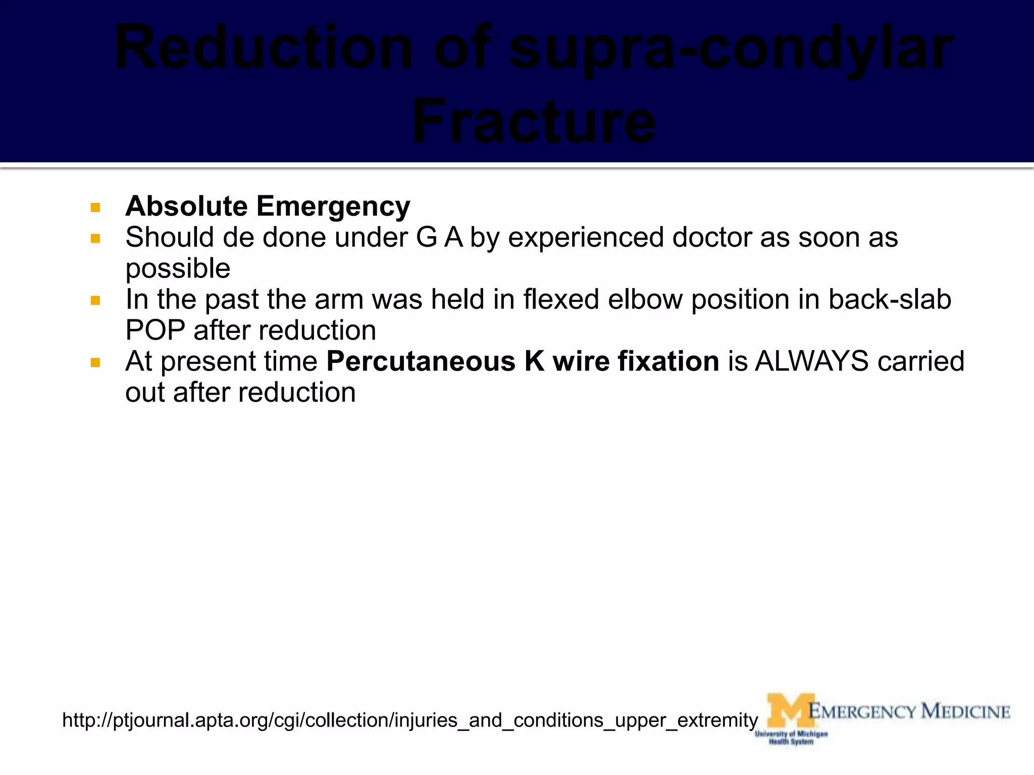  Absolute Emergency
 Should de done under G A by experienced doctor as soon as
possible
 In the past the arm was held in flexed elbow position in back-slab
POP after reduction
 At present time Percutaneous K wire fixation is ALWAYS carried
out after reduction
http://ptjournal.apta.org/cgi/collection/injuries_and_conditions_upper_extremity
 