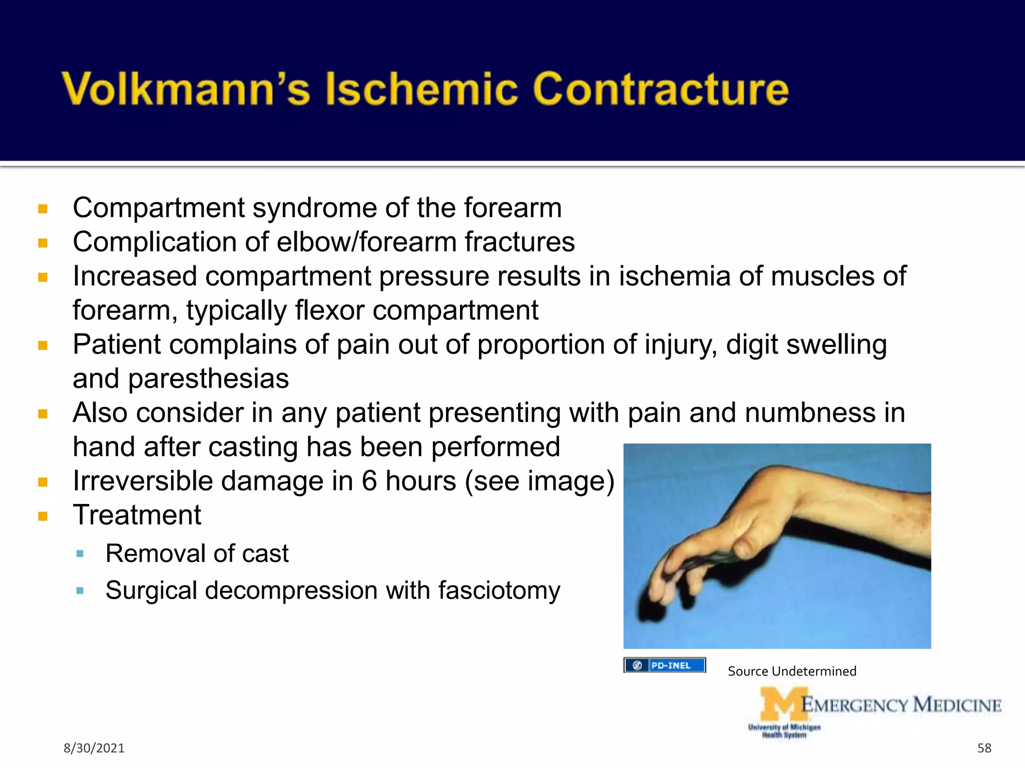  Compartment syndrome of the forearm
 Complication of elbow/forearm fractures
 Increased compartment pressure results in ischemia of muscles of
forearm, typically flexor compartment
 Patient complains of pain out of proportion of injury, digit swelling
and paresthesias
 Also consider in any patient presenting with pain and numbness in
hand after casting has been performed
 Irreversible damage in 6 hours (see image)
 Treatment
 Removal of cast
 Surgical decompression with fasciotomy
58
Source Undetermined
8/30/2021
 