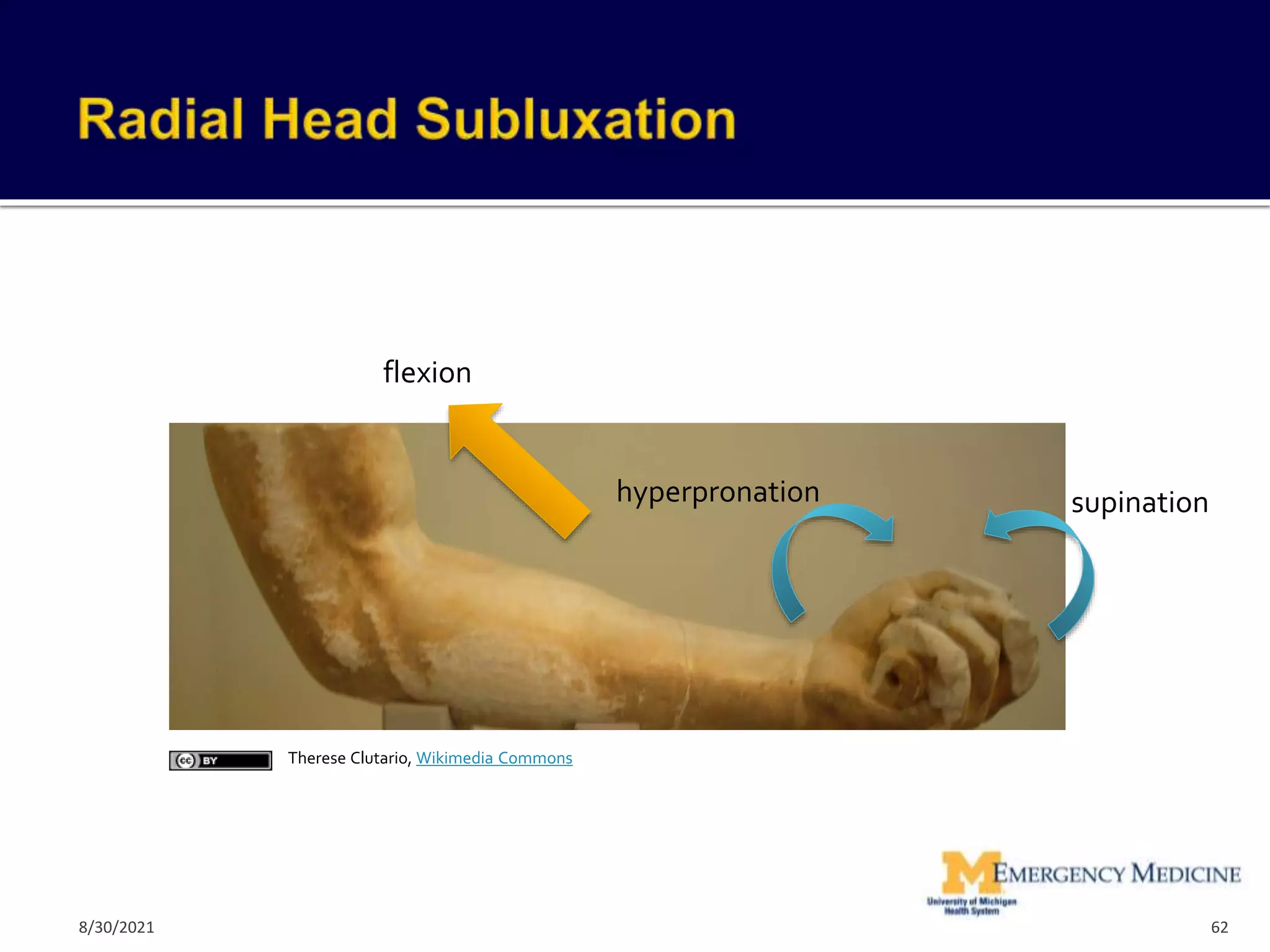 62
Therese Clutario, Wikimedia Commons
hyperpronation supination
flexion
8/30/2021
 