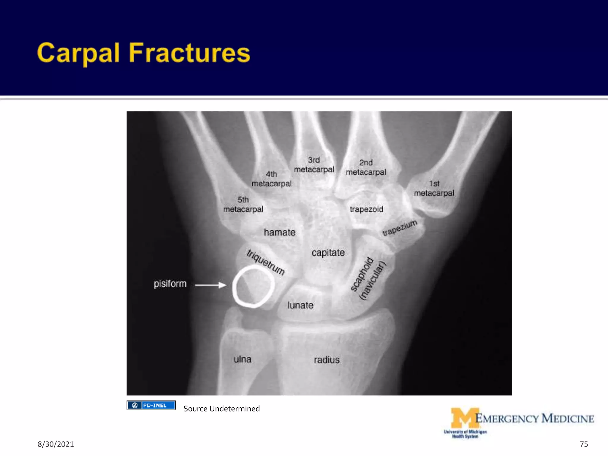 75
Source Undetermined
8/30/2021
 