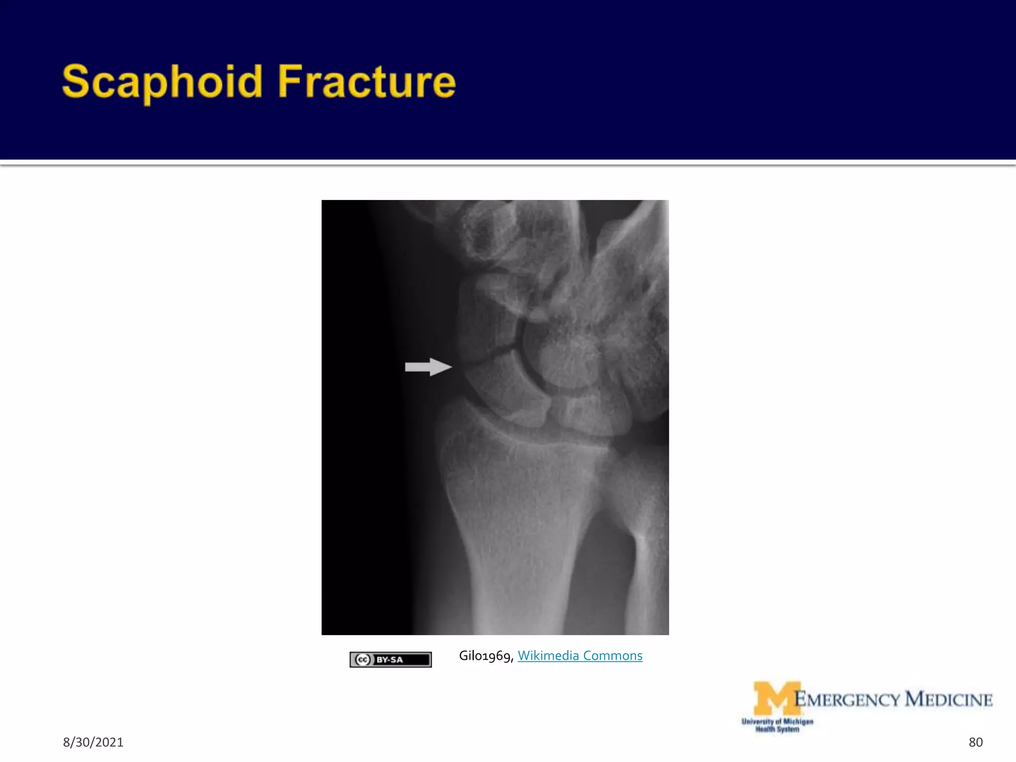 80
Gilo1969, Wikimedia Commons
8/30/2021
 