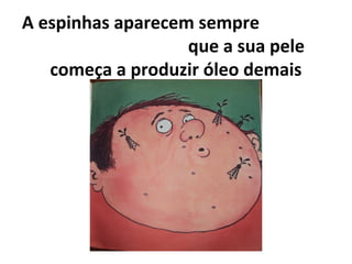 A espinhas aparecem sempre
que a sua pele
começa a produzir óleo demais
 