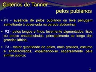 Critérios de Tanner
                                  pelos pubianos
 P1 - ausência de pelos pubianos ou leve penugem
 semelhante à observada na parede abdominal;

 P2 - pelos longos e finos, levemente pigmentados, lisos
 ou pouco encaracolados, principalmente ao longo dos
 grandes lábios;

 P3 - maior quantidade de pelos, mais grossos, escuros
 e encaracolados, espalhando-se esparsamente pela
 sínfise púbica;


                                                      10
 