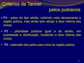 Critérios de Tanner
                                  pelos pubianos
 P4 - pelos do tipo adulto, cobrindo mais densamente a
 região púbica, mas ainda sem atingir a face interna das
 coxas;

 P5 - pilosidade pubiana igual a do adulto, em
 quantidade e distribuição, invadindo a face interna das
 coxas;

 P6 - extensão dos pelos para cima da região púbica.




                                                        11
 