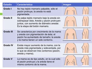 Estadio Característica Imagen
Grado I No hay tejido mamario palpable, sólo el
pezón protruye, la areola no está
pigmentada.
Grado II Se palpa tejido mamario bajo la areola sin
sobrepasar ésta. Areola y pezón protruyen
juntos, con aumento de diámetro areolar.
Es la etapa del botón mamario.
Grado III Se caracteriza por crecimiento de la mama
y areola con pigmentación de ésta; el
pezón ha aumentado de tamaño; la areola
y la mama tienen un solo contorno.
Grado IV Existe mayor aumento de la mama, con la
areola más pigmentada y solevantada, por
lo que se observan tres contornos (pezón,
areola y mama).
Grado V La mama es de tipo adulto, en la cual sólo
el pezón protruye y la aréola tiene el
mismo contorno de la mama.
 