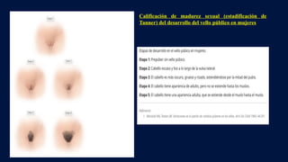 Calificación de madurez sexual (estadificación de
Tanner) del desarrollo del vello público en mujeres
 