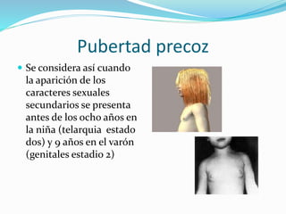 Pubertad precoz 
 Se considera así cuando 
la aparición de los 
caracteres sexuales 
secundarios se presenta 
antes de los ocho años en 
la niña (telarquia estado 
dos) y 9 años en el varón 
(genitales estadio 2) 
 