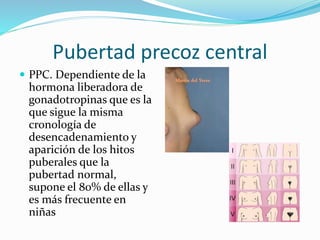 Pubertad precoz central 
 PPC. Dependiente de la 
hormona liberadora de 
gonadotropinas que es la 
que sigue la misma 
cronología de 
desencadenamiento y 
aparición de los hitos 
puberales que la 
pubertad normal, 
supone el 80% de ellas y 
es más frecuente en 
niñas 
 