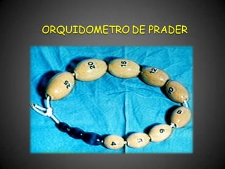 ORQUIDOMETRO DE PRADER
 