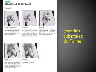 Estadios
puberales
de Tanner
 