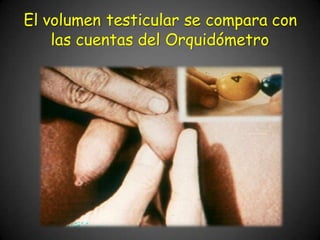 El volumen testicular se compara con
las cuentas del Orquidómetro
 