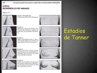Estadios
de Tanner
 