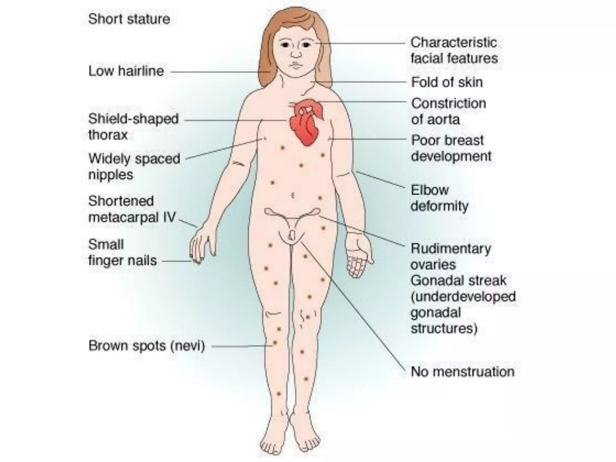 Puberty Issues Puberty disorders | PDF