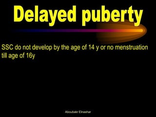 SSC do not develop by the age of 14 y or no menstruation till age of 16y 
Aboubakr Elnashar  