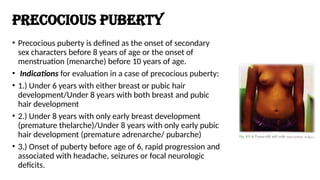 Puberty Issues PUBERTY DISORDERs ppt by doc maney .pptx