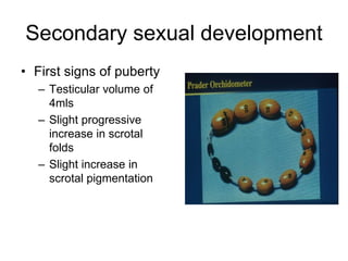 Secondary sexual development
• First signs of puberty
– Testicular volume of
4mls
– Slight progressive
increase in scrotal
folds
– Slight increase in
scrotal pigmentation
 