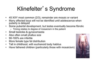 Klinefelter’s Syndrome
• 45 XXY most common (2/3), remainder are mosaic or variant
• Many affected boys will not be identified until adolescence when
puberty is delayed
• Some pubertal development, but testes eventually become fibrotic
– Timing relates to degree of mosaicism in the patient
• Small testicles & gynecomastia
• Also often small phallus size
• 90-100% are infertile
• More female type fat distribution
• Tall in childhood, with euchanoid body habitus
• Have fathered children (particularly those with mosaicism)
 