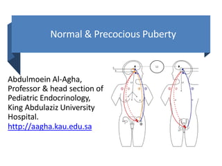 Normal & Precocious Puberty
Abdulmoein Al-Agha,
Professor & head section of
Pediatric Endocrinology,
King Abdulaziz University
Hospital.
http://aagha.kau.edu.sa
 
