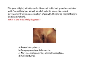 Puberty Normal And Precocious