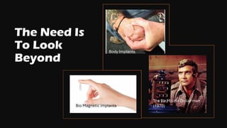 The Need Is
To Look
Beyond
The Six Million Dollar man
(1970)
Body Implants
Bio Magnetic implants
 