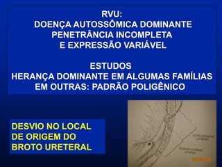 RVU:
DOENÇA AUTOSSÔMICA DOMINANTE
PENETRÂNCIA INCOMPLETA
E EXPRESSÃO VARIÁVEL
ESTUDOS
HERANÇA DOMINANTE EM ALGUMAS FAMÍLIAS
EM OUTRAS: PADRÃO POLIGÊNICO
DESVIO NO LOCAL
DE ORIGEM DO
BROTO URETERAL
 