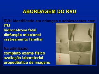 ABORDAGEM DO RVU
RVU identificado em crianças e adolescentes com
ITU
hidronefrose fetal
disfunção miccional
rastreamento familiar
Na admissão:
completo exame físico
avaliação laboratorial
propedêutica de imagens
 