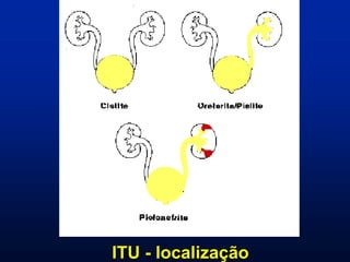 ITU - localização
 