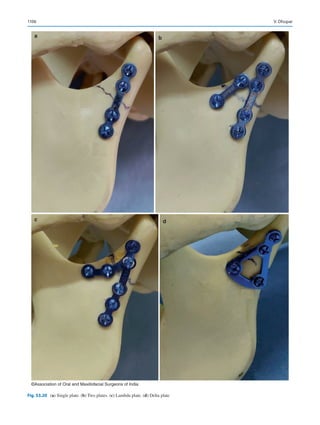 Publication- acknowledgement-AOMSI_Book- 1698.pdf