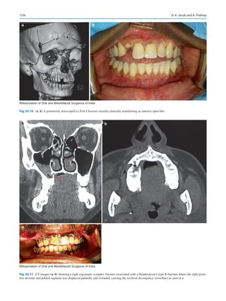Publication- acknowledgement-AOMSI_Book- 1698.pdf