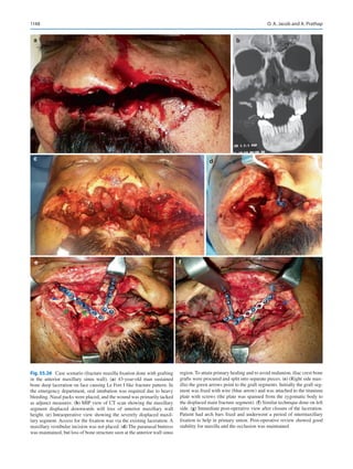 Publication- acknowledgement-AOMSI_Book- 1698.pdf